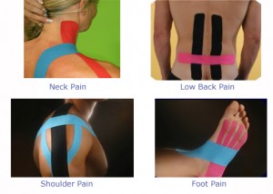 Kinesio Taping