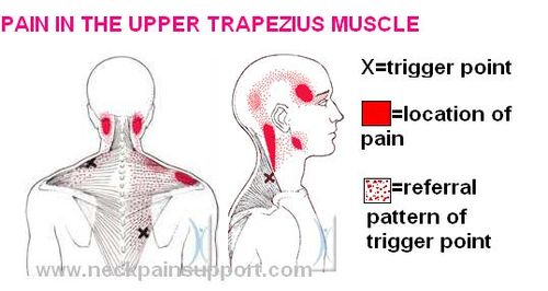 Headaches & TMJ Dysfunction Muscleworx Clinic - Mark Mc Cormick